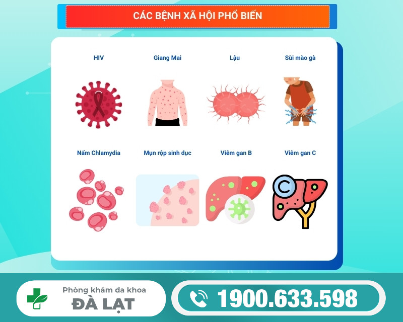 Hình ảnh minh họa